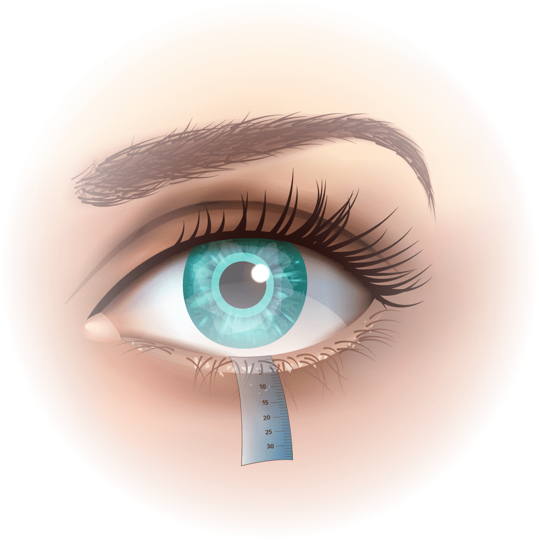 test schirmer secheresse oculaire